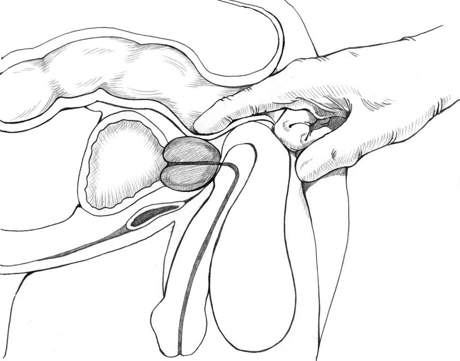 A massagem da próstata está incluída no complexo de métodos de tratamento da prostatite